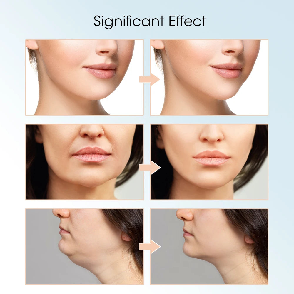 Appareil de levage du visage, thérapie photonique LED, masseur amincissant par vibrations, Double menton en V, Machine à ceinture de levage des joues en forme de visage