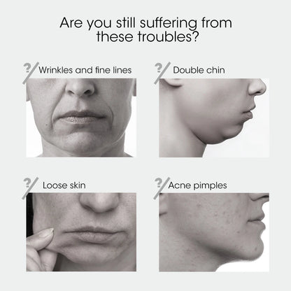 Appareil de Lifting du visage, lumière rouge, rajeunissement de la peau, masseur du visage en V, Double menton, avec télécommande, Instrument de beauté du visage